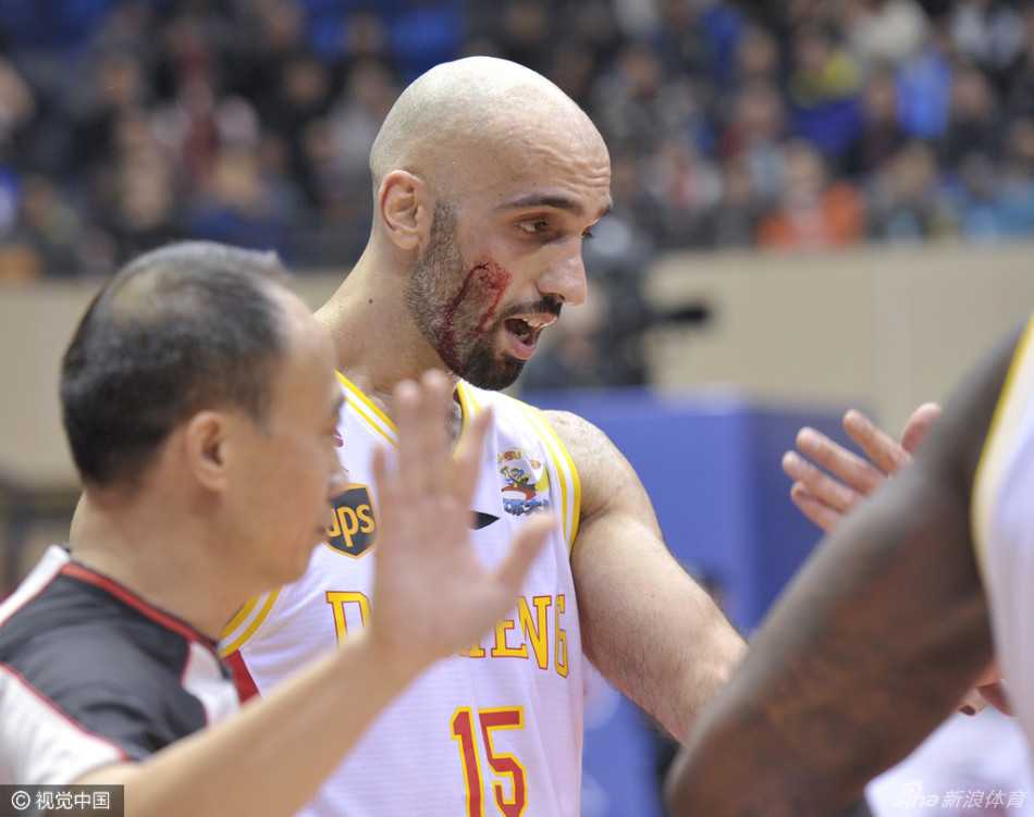 下半场阿巴斯带伤上阵，眼角贴着醒目的胶布，在比赛中依然奋力拼抢。