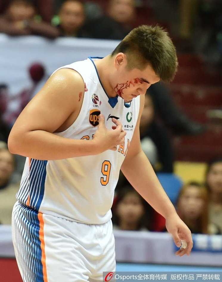 徐煜峰眉骨开裂瞬间，鲜血顺流而下，他紧皱眉头用手捂住伤口，眼神中透露出一丝不甘